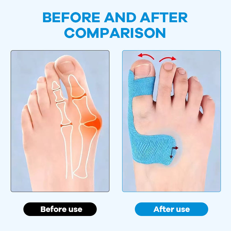 Förskuren kinesiologitejp för hallux valgus