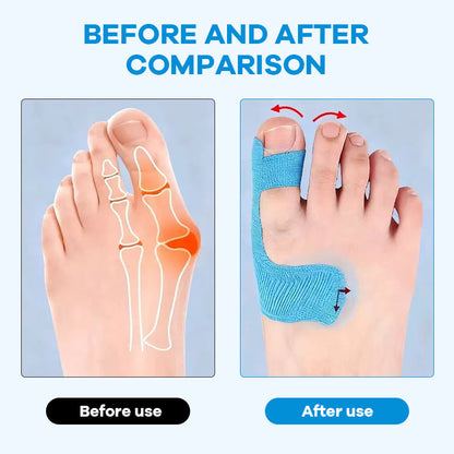Förskuren kinesiologitejp för hallux valgus