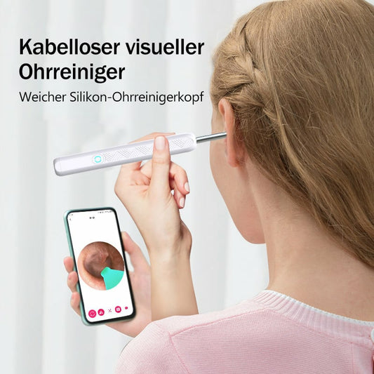 🔥👂Trådlösa endoskopiska öronskedar